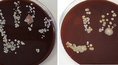Odporné: Takéto množstvo baktérií nás obklopuje v práci