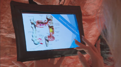 Týždenne na to zomiera 32 Slovákov. Vyšetrenie, ktoré im mohlo zachrániť život, mnohí odmietajú