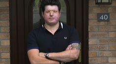 Chcel pomstiť príbuzného, kúpil kyselinu a vyrazil. Život zničil nevinnému mužovi