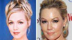 Aj ona podľahla plastike. Kelly z Beverly Hills natiahnutá a pribratá