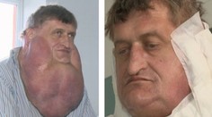 V Martine z tohto muža urobili opäť toho, kým bol