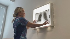 Dlhé čakacie lehoty, málo pľúcnych lekárov. V Banskobystrickom kraji končia viacerí pneumológovia, hovoria o kríze