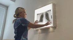 Dlhé čakacie lehoty, málo pľúcnych lekárov. V Banskobystrickom kraji končia viacerí pneumológovia, hovoria o kríze