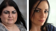 Za pol roka stratila štíhlu postavu a pribrala 50 kíl. Pre záhadnú chorobu