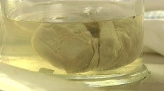 Neveril vlastným očiam! Kus svojho tela objavil v dome hrôzy