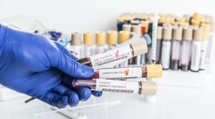 Variant deltakron môže byť výsledkom chybnej analýzy