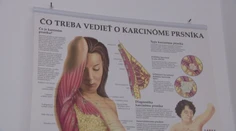 Aj po chemoterapii môže prísť na svet nový život. Projekt búra mýty o tehotenstve onkologických pacientiek