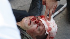 Ďalšia vlna nepokojov v Kyjeve. Policajt neprežil, sto ľudí je zranených