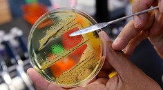 WHO zverejnila zoznam najnebezpečnejších baktérií