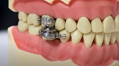 Novodobé chudnutie alebo spôsob mučenia? Vedci predstavili magnetický prístroj na chudnutie