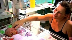 Boli na tomto svete iba 19 dní: Siamské dvojčatá prehrali boj so smrťou