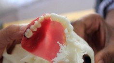 Prišiel o hornú čeľusť. Pomohla mu 3D tlačiareň