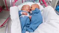 Jedinečný zákrok v bratislavskej nemocnici. Dvojičky operovali ešte počas tehotenstva mamy, zachránili im život
