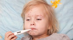 Aj na Slovensku môžu vzniknúť epidémie osýpok, varuje hlavný hygienik