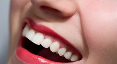 Sexi úsmev: Vybieľte si zuby doma a zadarmo!