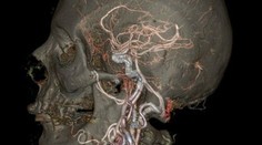 Mozog, srdce a žily ako ste ich nikdy pred tým nevideli