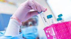 Česko hlási prvý prípad mutácie covidu s názvom lambda. Ako veľmi je nebezpečná?