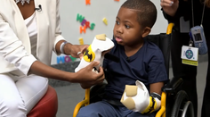 Prvému dieťaťu úspešne transplantovali ruky. Pozrite, ako si splnil sen