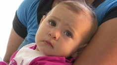 Dievčatko sa narodilo bez časti rebier. Lekári takto skoncovali s jej utrpením