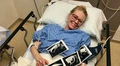 Päť rokov nevedela otehotnieť. Ultrazvuk napokon odhalil, že čaká prekvapivo veľa detí