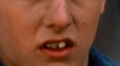 Vtedy a dnes zuby hollywoodskych hviezd: S takým úsmevom by svet rozhodne neočarili