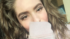 Česká hviezda, ktorú popálili na dovolenke, sa dočkala. Veľký návrat