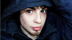 Muž (25) minul takmer 30-tisíc eur, aby vyzeral ako elf. Pozrite si výsledok