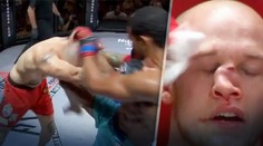Po zásahu kolenom mal jeho nos tvar písmena “C“. MMA bojovník prosil rozhodcu, aby ho nechal pokračovať