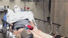 Žena chcela sfúknuť sviečku, tá jej však explodovala rovno do tváre