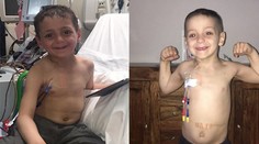 Smrteľne chorý chlapec sa neprestáva usmievať. Jeho fotka inšpirovala svet