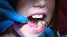 Výrazne sa zmenia preventívky, ktoré bude hradiť poisťovňa