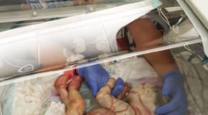 Keď sa narodila, nevyzerala ako človek. Napriek zlej prognóze oslávi prvý rok