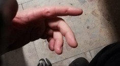 Rušná sviatočná noc bratislavských policajtov. Opitý a agresívny muž sa jednému z nich zahryzol do ruky