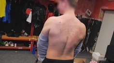 Majú perfektne vyformované telá, no plné vyrážok. Dermatologička vysvetľuje, prečo akné trápi profesionálnych športovcov