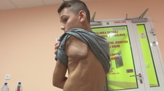 Príbehy detských hrdinov zo Slovenska. Prežili viacej bolesti, ako ktorýkoľvek dospelý