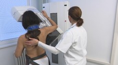 Slovensko spúšťa celonárodné pátranie po rakovine. Zameria sa na tri najviac vyskytované