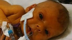 Otec nechal zretušovať foto chorej dcéry. Dôvod vás prekvapí aj dojme