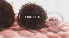 Ľudské telo dokáže s nádormi bojovať samo. Stačí správne nastaviť bunky