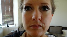 Chcela byť krásna, teraz je nešťastná. Solárium Britke spôsobilo rakovinu