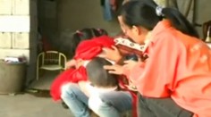 Dievčatko (3) má chrbát pokrytý hustou srsťou