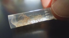 Nenápadný zabijak domácich miláčikov. Veterinári upozorňujú na pľúcne červy