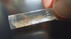 Nenápadný zabijak domácich miláčikov. Veterinári upozorňujú na pľúcne červy