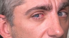 Cyklista mal po hádke napadnúť vodiča auta. Zrejme prišiel o zrak na pravom oku