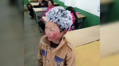 Chlapec so zamrznutými vlasmi sa stal internetovou senzáciou. Jeho príbeh vás chytí za srdce