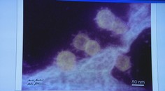 Ako vyzerá covid naozaj? Ukážeme vám snímky, ktoré sa podarili slovenským vedcom