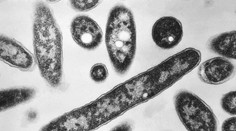 Počet úmrtí súvisiacich s legionárskou chorobou stúpol v Poľsku na 19. Zdroj nákazy úrady stále nezistili