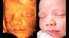 Nové šokujúce fakty. Alkohol počas tehotenstva mení bábätku črty tváre