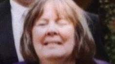 Zubár ako z hororu: Dôchodkyni vytrhol naraz 20 zubov a zomrela