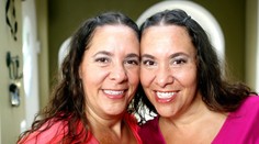 Závislé dvojčatá: Za 15 rokov neboli bez seba viac ako 30 minút