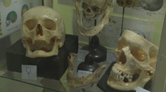 Naše telo dokáže pomáhať aj po smrti. Darovať ho na vedecké účely u nás nie je bežné